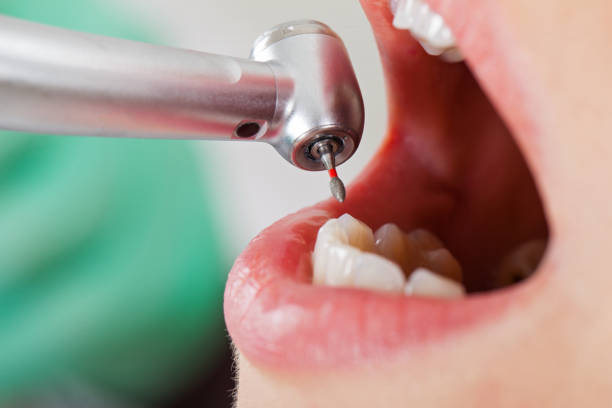 Best Emergency Dental Care for Sports Injuries in Barboursville, WV